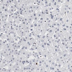 MEF2D Antibody, Novus Biologicals:Antibodies:Primary Antibodies