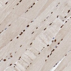 MEF2D Antibody, Novus Biologicals:Antibodies:Primary Antibodies