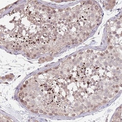 MEI1 Antibody, Novus Biologicals 25 &mu;L, Unlabeled:Antibodies, Polyclonal