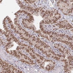MEIS1 Antibody, Novus Biologicals 0.1mL; Unlabeled:Antibodies, Polyclonal