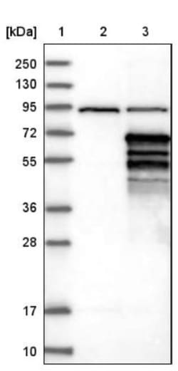 MEIS2 Antibody, Novus Biologicals 0.1mL; Unlabeled:Antibodies, Polyclonal