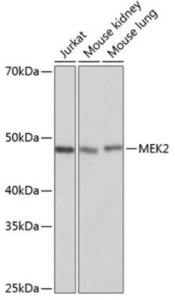 MEK2 Rabbit anti-Human, Mouse, Clone: 6D5K1, Novus Biologicals:Antibodies:Primary