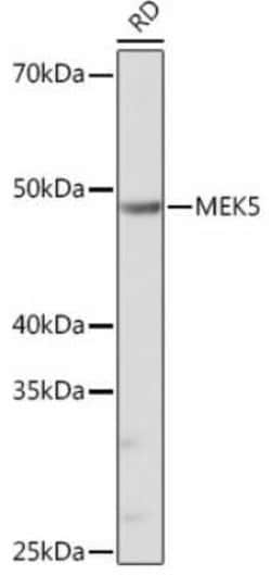 MEK5 Rabbit anti-Human, Mouse, Rat, Clone: 7B7O10, Novus Biologicals 20 &mu;g | Buy Online | Novus Biologicals | Fisher Scientific