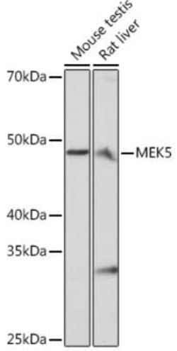 MEK5 Rabbit anti-Human, Mouse, Rat, Clone: 7B7O10, Novus Biologicals 20 &mu;g | Buy Online | Novus Biologicals | Fisher Scientific