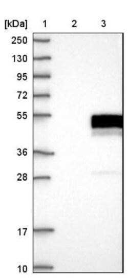 MEK5 Antibody, Novus Biologicals:Antibodies:Primary Antibodies