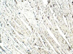 MEKK4 Antibody, Novus Biologicals 100 &mu;g | Buy Online | Novus Biologicals | Fisher Scientific