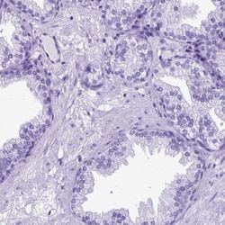 MEOX 2 Antibody, Novus Biologicals 0.1mL; Unlabeled:Antibodies, Polyclonal