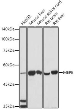 MEPE/OF45 Rabbit anti-Human, Mouse, Rat, Polyclonal, Novus Biologicals
