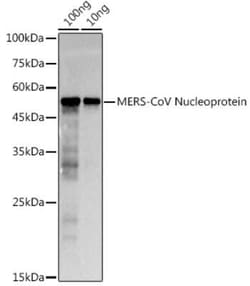 MERS-CoV Nucleoprotein Rabbit anti-MERS-CoV, Polyclonal, Novus Biologicals 20 &mu;g | Buy Online | Novus Biologicals | Fisher Scientific