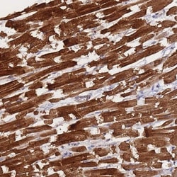Meteorin Antibody, Novus Biologicals 0.1mL; Unlabeled:Antibodies, Polyclonal