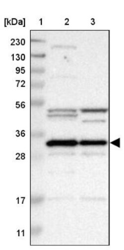 METTL1 Antibody, Novus Biologicals 25 &mu;L | Buy Online | Novus Biologicals | Fisher Scientific