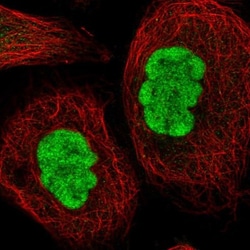 METTL14 Antibody, Novus Biologicals 25 &mu;L; Unlabeled:Antibodies, Polyclonal