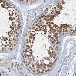 METTL14 Antibody, Novus Biologicals 25 &mu;L; Unlabeled:Antibodies, Polyclonal