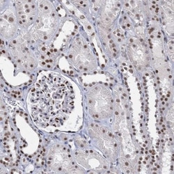 METTL14 Antibody, Novus Biologicals 25 &mu;L; Unlabeled:Antibodies, Polyclonal