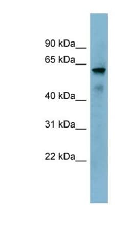 METTL14 Antibody, Novus Biologicals 0.05mg; Unlabeled:Antibodies, Polyclonal