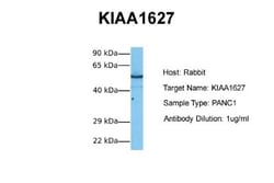 METTL14 Antibody, Novus Biologicals 0.05mg; Unlabeled:Antibodies, Polyclonal