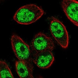METTL19 Antibody, Novus Biologicals 0.1mL; Unlabeled:Antibodies, Polyclonal