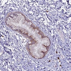 METTL25 Antibody, Novus Biologicals:Antibodies:Primary Antibodies