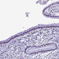 METTL25 Antibody, Novus Biologicals 25 &mu;L | Buy Online | Novus Biologicals | Fisher Scientific