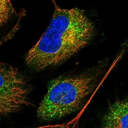 METTL7B Antibody, Novus Biologicals 0.1mL; Unlabeled:Antibodies, Polyclonal