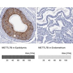 METTL7B Antibody, Novus Biologicals 0.1mL; Unlabeled:Antibodies, Polyclonal