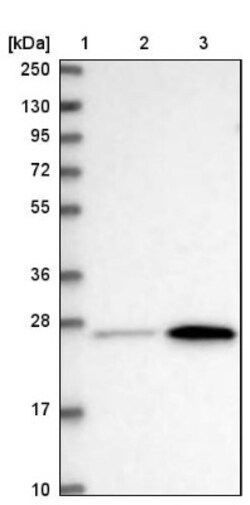 METTL7B Antibody, Novus Biologicals 0.1mL; Unlabeled:Antibodies, Polyclonal