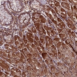MEX3C Antibody, Novus Biologicals 0.1mL; Unlabeled:Antibodies, Polyclonal