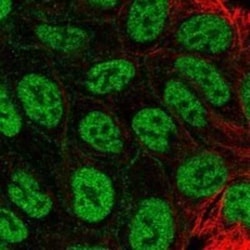 MFAP3L Rabbit anti-Human, Polyclonal, Novus Biologicals:Antibodies:Primary