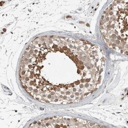 MFAP3L Antibody, Novus Biologicals 0.1mL; Unlabeled:Antibodies, Polyclonal