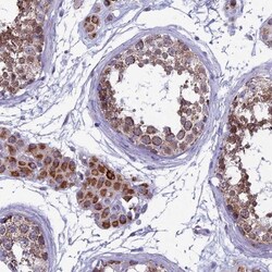 MFSD12 Antibody, Novus Biologicals 0.1mL; Unlabeled:Antibodies, Polyclonal