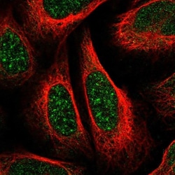 MFSD2B Antibody, Novus Biologicals:Antibodies:Primary Antibodies