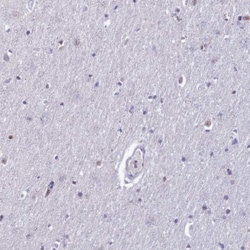 MFSD2B Antibody, Novus Biologicals:Antibodies:Primary Antibodies