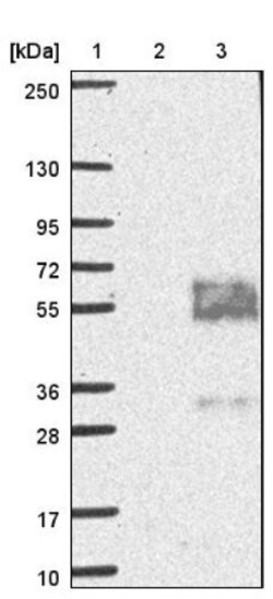 MFSD8 Antibody, Novus Biologicals 25 &mu;L, Unconjugated:Antibodies, Polyclonal