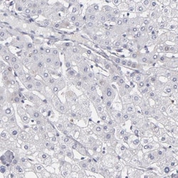 MGAM Antibody, Novus Biologicals 0.1mL; Unlabeled:Antibodies, Polyclonal