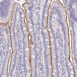 MGAM2 Antibody, Novus Biologicals:Antibodies:Primary Antibodies