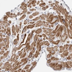 MGAT1 Antibody, Novus Biologicals 0.1mL; Unlabeled:Antibodies, Polyclonal