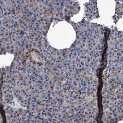 MGAT4A Antibody, Novus Biologicals 0.1mL; Unlabeled:Antibodies, Polyclonal