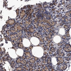 MGAT4A Antibody, Novus Biologicals 0.1mL; Unlabeled:Antibodies, Polyclonal