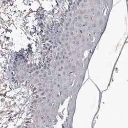 MGAT4A Antibody, Novus Biologicals 0.1mL; Unlabeled:Antibodies, Polyclonal