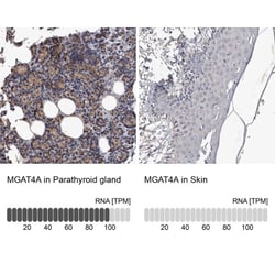 MGAT4A Antibody, Novus Biologicals 0.1mL; Unlabeled:Antibodies, Polyclonal