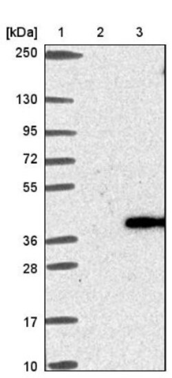 MGC16471 Antibody, Novus Biologicals 0.1mL; Unlabeled:Antibodies, Polyclonal