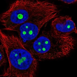 MGC20410 Antibody, Novus Biologicals:Antibodies:Primary Antibodies