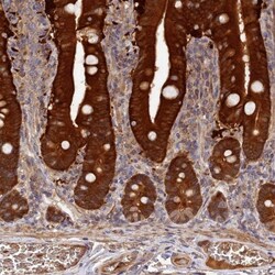 MGC4172 Antibody, Novus Biologicals:Antibodies:Primary Antibodies