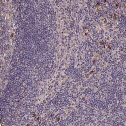 MGC4172 Antibody, Novus Biologicals:Antibodies:Primary Antibodies