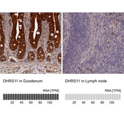 MGC4172 Antibody, Novus Biologicals:Antibodies:Primary Antibodies