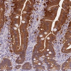 MGC4172 Antibody, Novus Biologicals 0.1mL; Unlabeled:Antibodies, Polyclonal