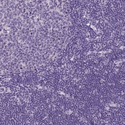MGC4172 Antibody, Novus Biologicals 0.1mL; Unlabeled:Antibodies, Polyclonal
