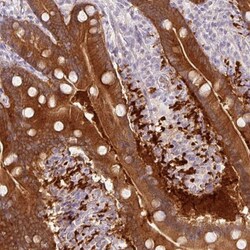 MGC4172 Antibody, Novus Biologicals 25 &mu;L, Unlabeled:Antibodies, Polyclonal