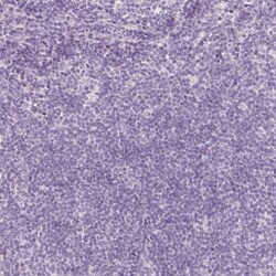 MGC4172 Antibody, Novus Biologicals 25 &mu;L, Unlabeled:Antibodies, Polyclonal