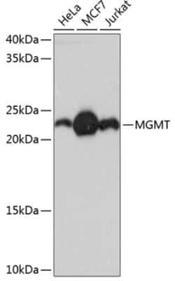 MGMT Rabbit anti-Human, Clone: 2A4X3, Novus Biologicals:Antibodies:Primary